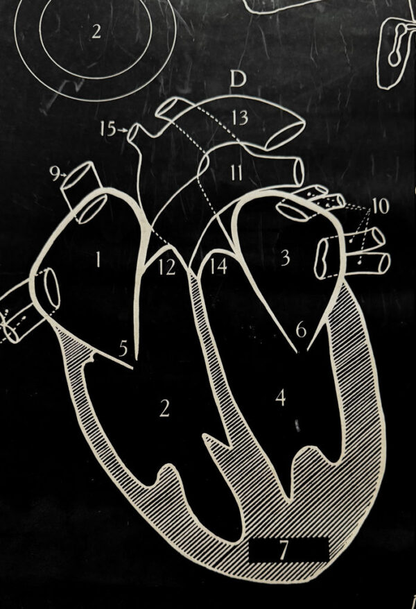 Anatomical heart & circulation chart Van In & Co, Lier – ca. 1940 (13)_resultaat Vintage anatomische schoolplaat Hart & Bloedsomloop – Anatomical heart & circulation chart Van In & Co, Lier – ca. 1940