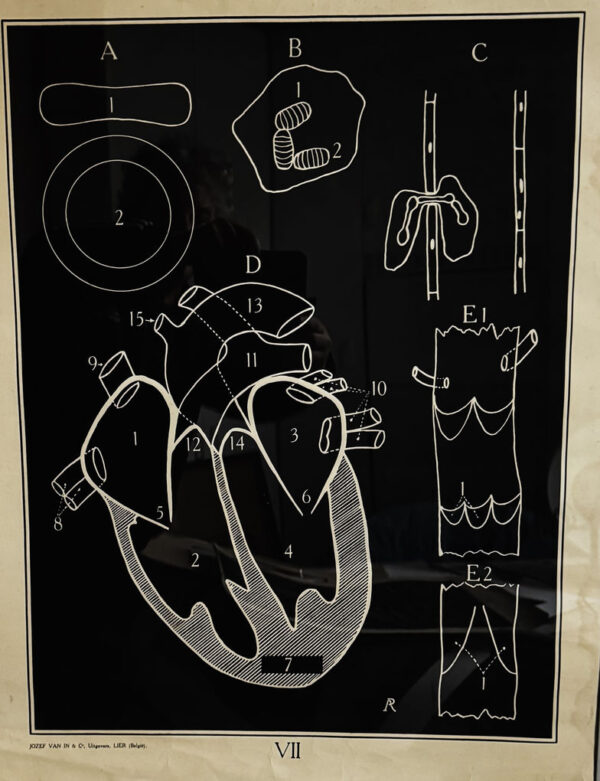 Anatomical heart & circulation chart Van In & Co, Lier – ca. 1940 (14)_resultaat Vintage anatomische schoolplaat Hart & Bloedsomloop – Anatomical heart & circulation chart Van In & Co, Lier – ca. 1940