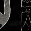 Anatomical heart & circulation chart Van In & Co, Lier – ca. 1940 (7)_resultaat Vintage anatomische schoolplaat Hart & Bloedsomloop – Anatomical heart & circulation chart Van In & Co, Lier – ca. 1940